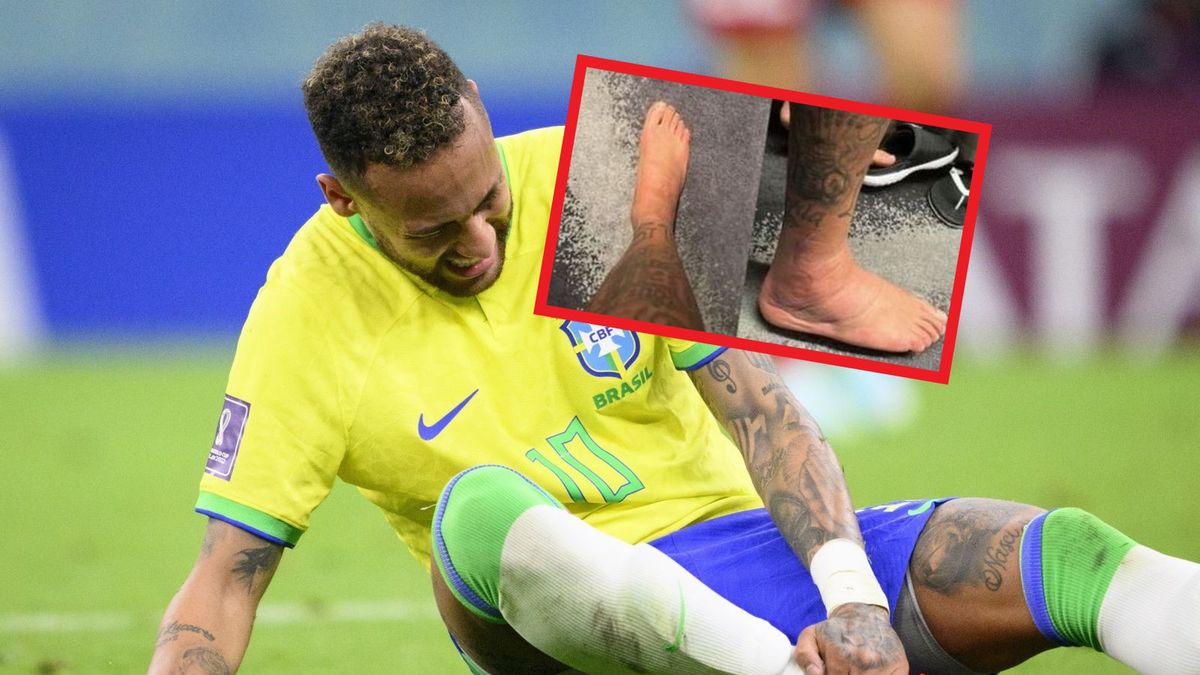 Neymar w meczu ze Szwajcarią, na małym zdjęciu: stopa Neymara po kontuzji