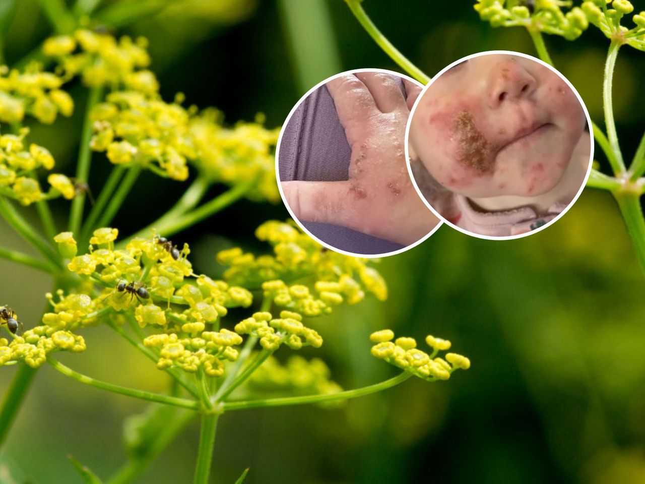 Tragiczny finał zabawy w ogrodzie. Dziewczynka chciała powąchać kwiatki