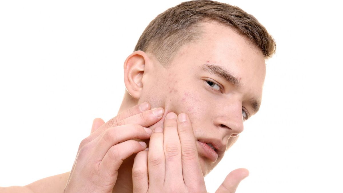 Trądzik posterydowy to choroba skóry i jeden z rodzajów trądziku. Jest on związany z używaniem sterydów, zarówno preparatów miejscowych, jak i sterydowych leków ogólnoustrojowych.