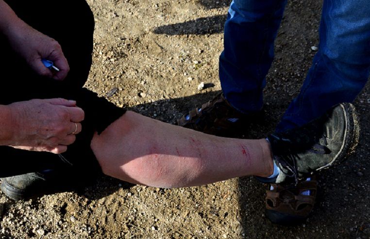 Co 15 minut zabija jedną osobę na świecie. "Objawy są wręcz potworne"