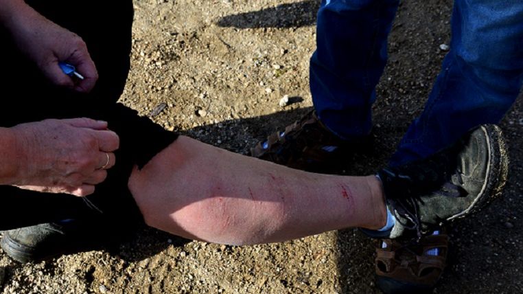 Zabija niemal 100 proc. zakażonych. "Pojawienie się objawów to niemal wyrok"