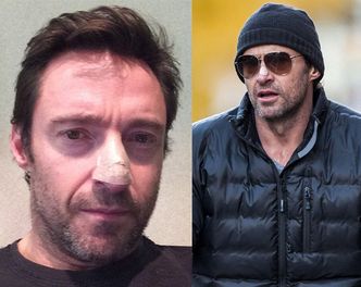 Hugh Jackman MIAŁ RAKA SKÓRY!