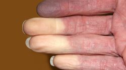 Zmiana koloru placów jest niepokojąca. Zobacz, o czym świadczy