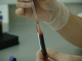 Badania krwi - charakterystyka, skład krwi, normy, interpretacja wyników