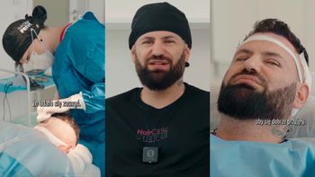 Wojtek Gola zafundował sobie PRZESZCZEP WŁOSÓW. "Z czasem ta korona głowy może mi zacząć łysieć". Lepiej dmuchać na zimne?
