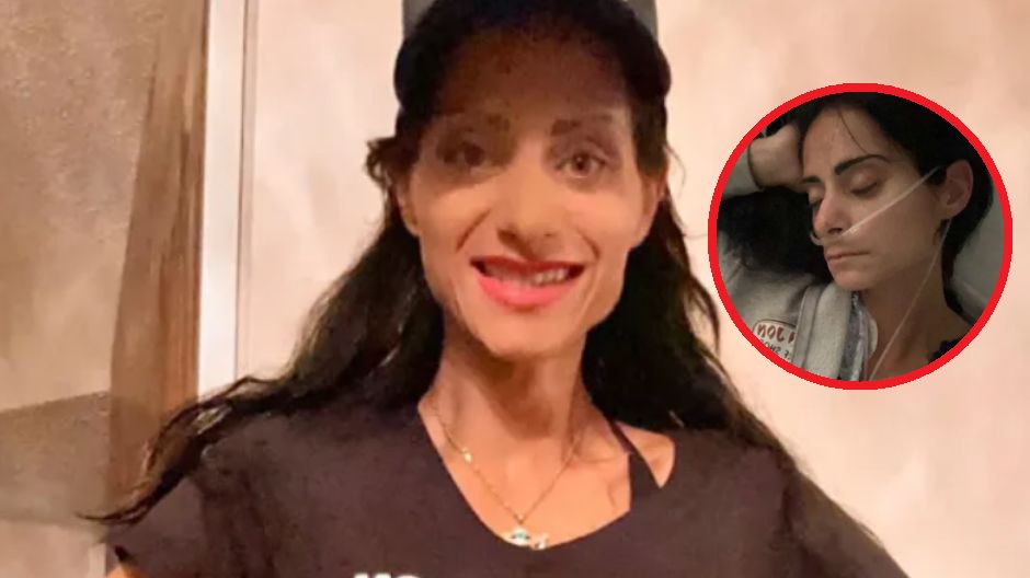 Czym jest zespół "sztywnego człowieka"?