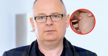Generuje nawet 90 proc. przypadków raka płuc. Te objawy są widoczne gołym okiem