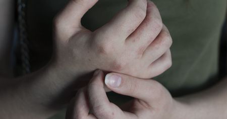 Powoli wyniszcza całe ciało. To znak, że jesz go za dużo