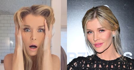 Joanna Krupa twierdzi, że zabiegi laserowe ZNISZCZYŁY jej cerę. "Uciekajcie od tego. To jest MASAKRA"