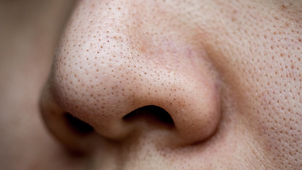 Maseczka domowej roboty pozwala szybko pozbyć się zaskórników