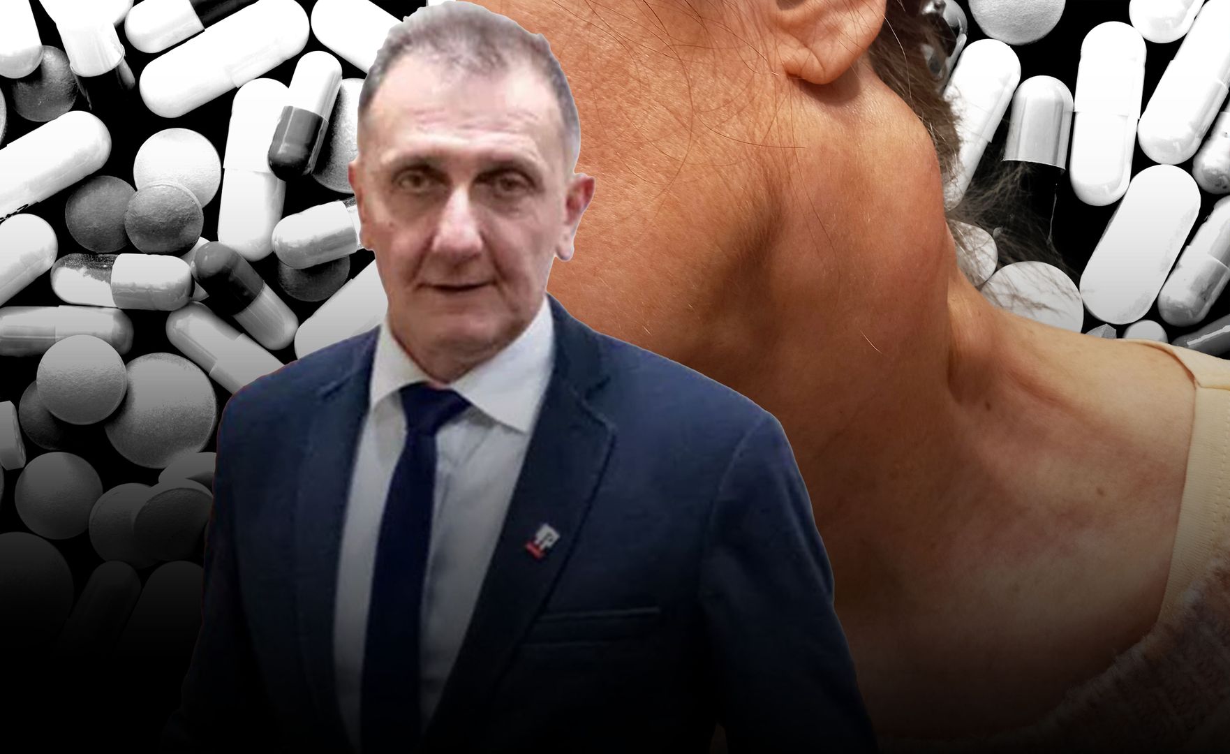 Hubert Czerniak i guz na szyi pani Betay