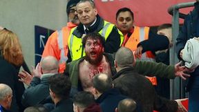 Pojedynki na pięści, krew i wielki wstyd. Zobacz sceny z meczu Anglia - Szkocja