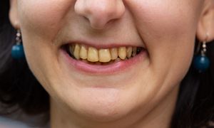 Długość życia zapisana w zębach. Naukowcy już wiedzą