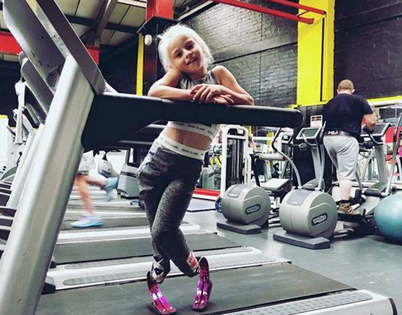 Ma 7 lat, dwie protezy nóg i apetyt na sławę. "Jest inspirująca, pełna energii i nic jej nie powstrzyma"