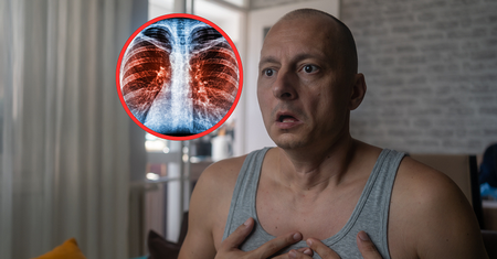 Zabija komórki raka płuc. "Przynosi niewiele skutków ubocznych"
