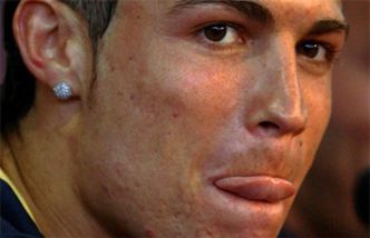 Zęby i cera Cristiano Ronaldo!