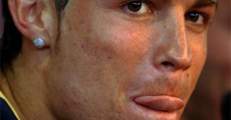 Zęby i cera Cristiano Ronaldo!