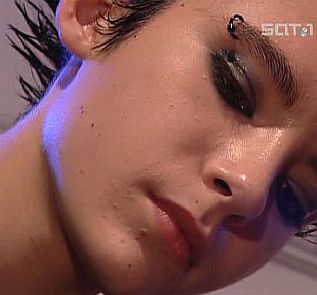 Niezdrowa cera Billa z Tokio Hotel