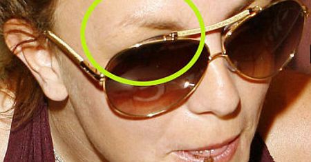 Co się stało z brwią Britney?