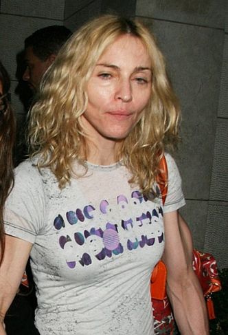 Madonna miała operację plastyczną?