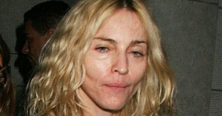 Madonna miała operację plastyczną?