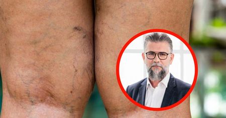 Wielu z nas boi się raka. "Mamy większego mordercę w Polsce"