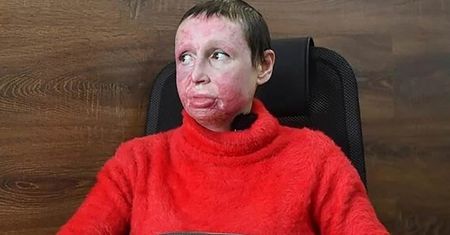 Została ukrzyżowana, a następnie podpalona. Szokująca zbrodnia w Rosji