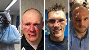 Makabryczne zdjęcia zawodników FEN po walkach we Wrocławiu!