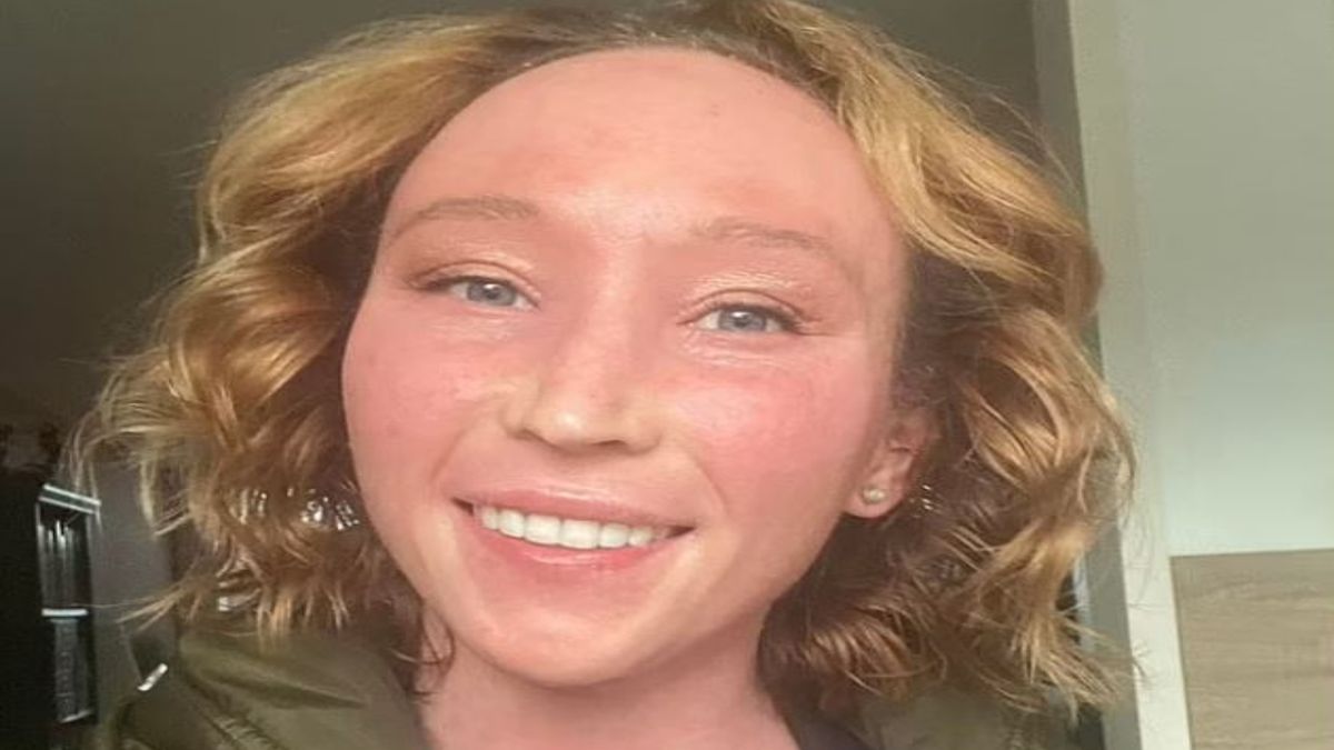 Od lat walczy z egzemą. Postanowiła odstawić krem ze sterydem. “Po pięciu miesiącach zaczęło się piekło”