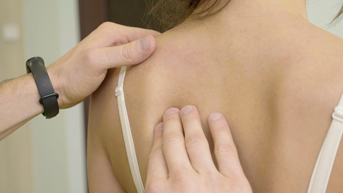 Skrzywienia kręgosłupa mogą być w pewnym stopniu dziedziczne