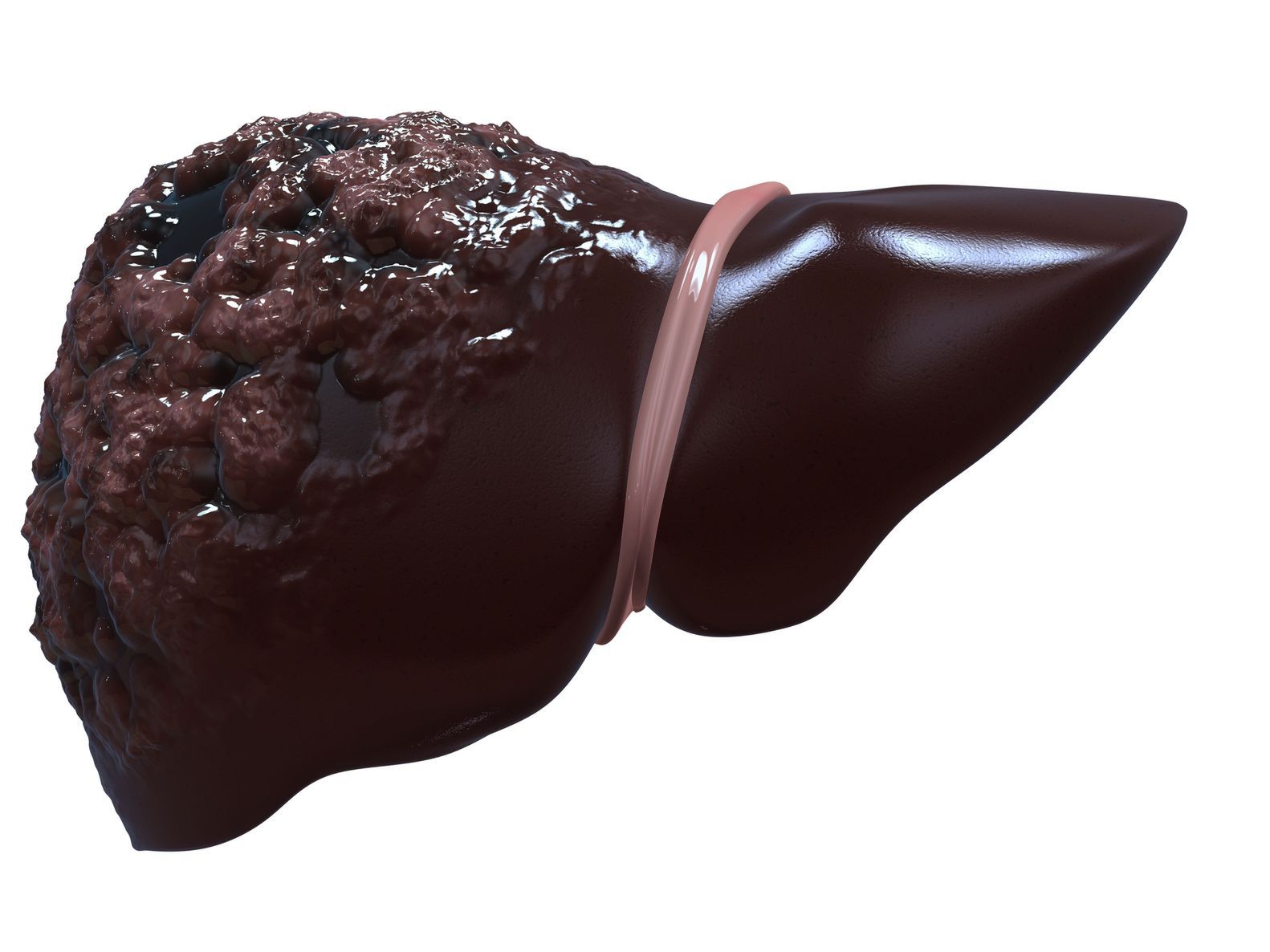 Chora wątroba u człowieka