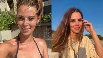 Małgorzata Tomaszewska pozuje w bikini i rozprawia o piegach. "Lubię w sobie to, jaka jestem" (FOTO)