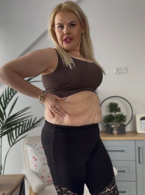 Kinga Zawodnik pokazała brzuch po operacji 