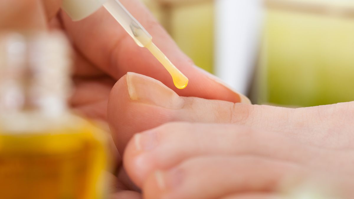 Undofen Amorolfina ma postać leczniczego lakieru do paznokci