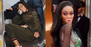 Dramat Winnie Harlow. Modelka z bielactwem musiała lecieć klasą ekonomiczną. "Jesteś TAKA ODWAŻNA"