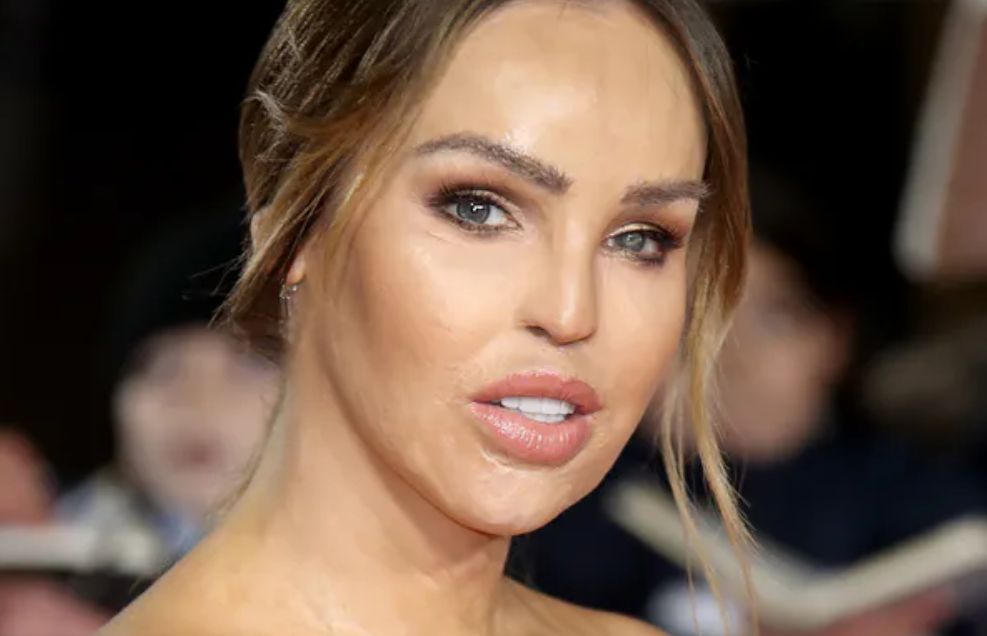 Katie Piper przeszłą kolejną operację. Wzruszające słowa Brytyjki