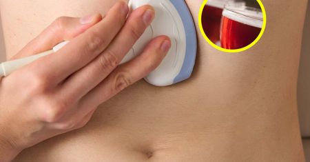 Hepatolog radzi, jak zadbać o wątrobę. Tych produktów unikaj