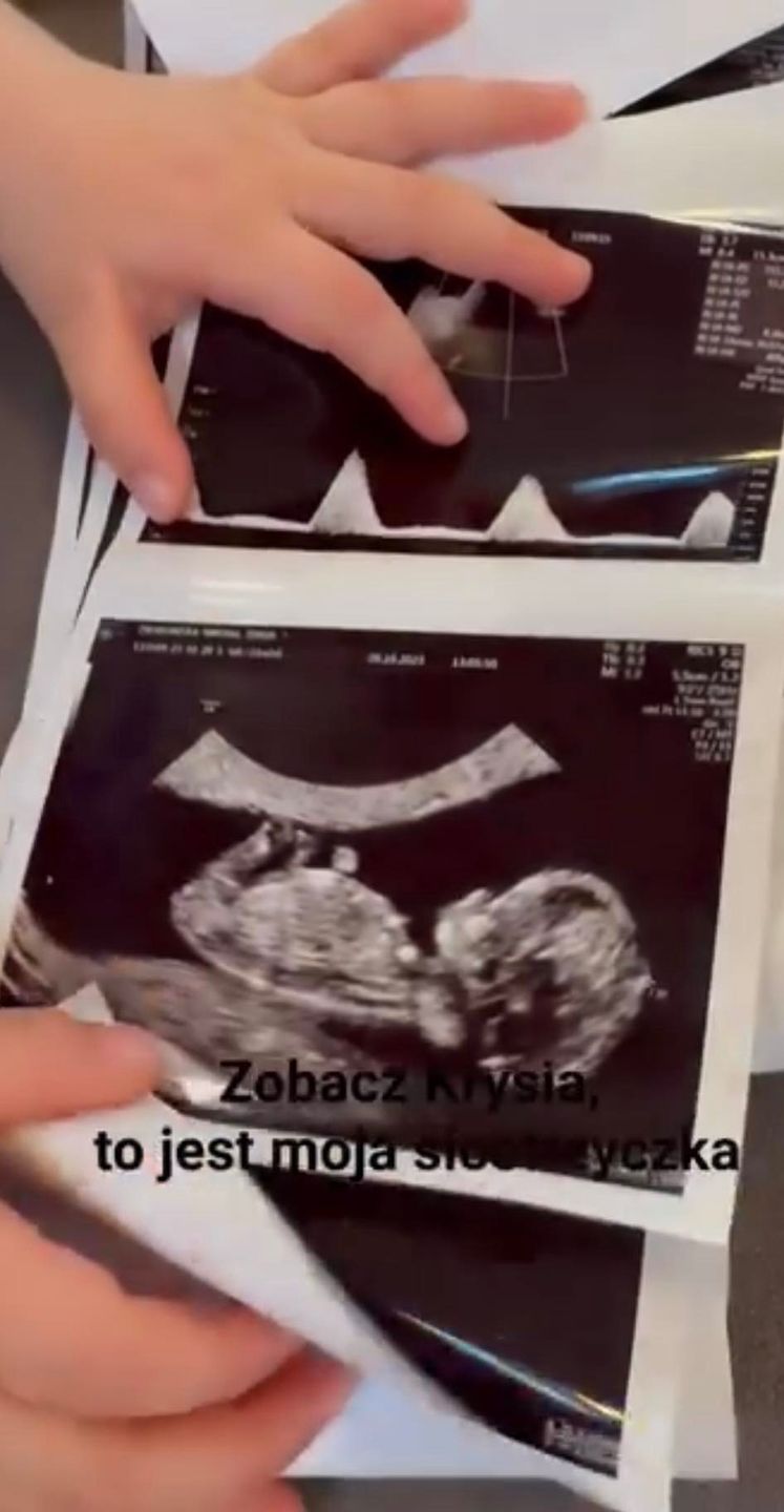 Zofia Zborowska ogłasza ciążę