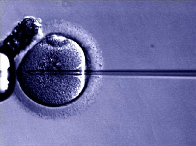 Ruszył proces lekarza obwinionego w sprawie pomyłki przy in vitro