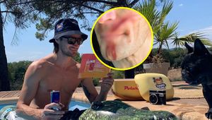 Tragedia w lesie. Ma szczęście, że żyje. "Ten człowiek za to odpowie"