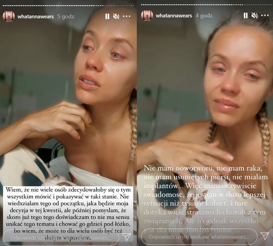 Anna Skura relacjonuje pobyt w szpitalu