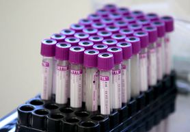 Test na koronawirusa - ile kosztuje? NFZ obniża stawkę