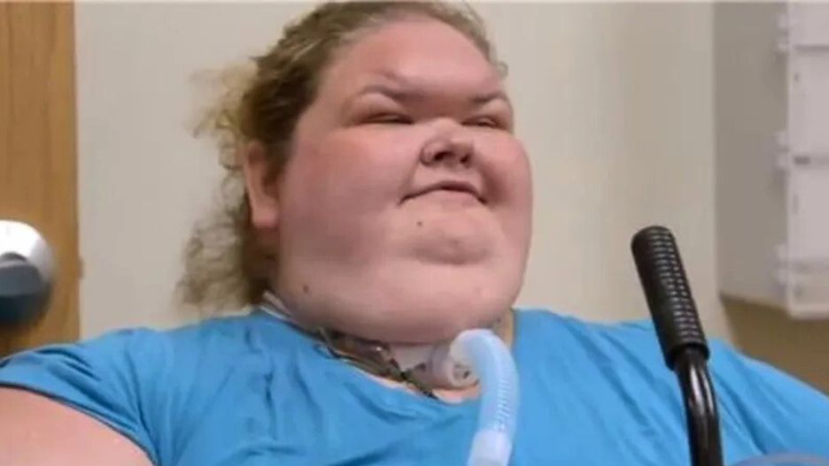 Tammy z "Sióstr wielkiej wagi" pokazała swoje nowe zęby