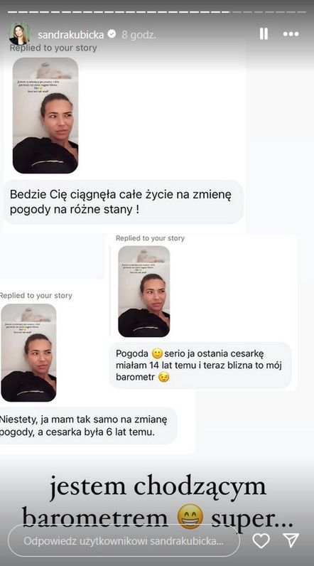 Sandra Kubicka narzeka na bliznę po cesarce