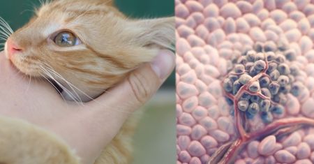 Toksoplazmoza powoduje glejaka mózgu. Naukowcy widzą taki związek