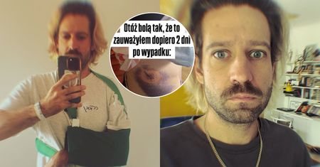 Polski komik miał dramatyczny wypadek. Jeden błąd mógł kosztować go życie