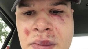 Białoruś. Milicjanci dotkliwie pobili hokeistę. Brał udział w proteście przeciw Łukaszence?