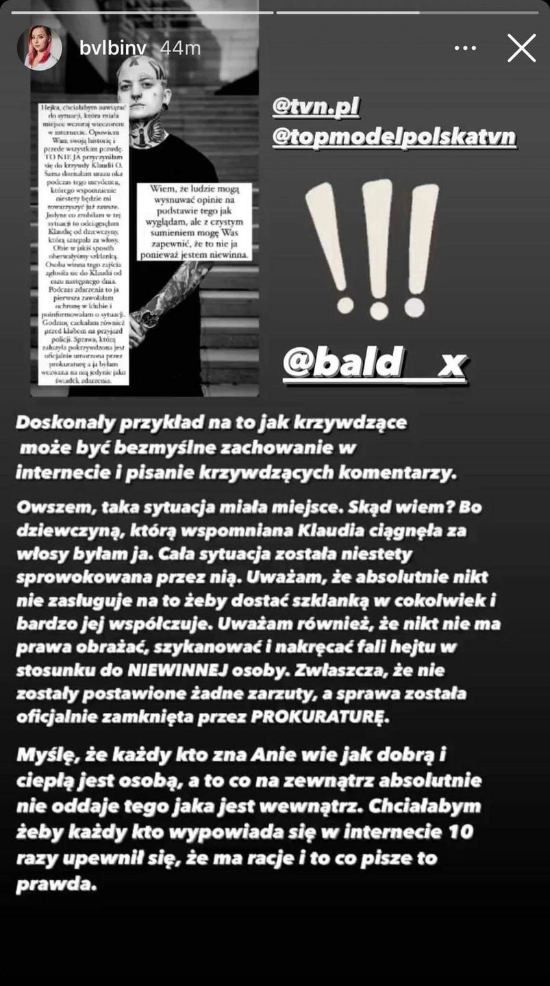 Uczestniczka "Top Model" odpowiada na zarzuty Internautki