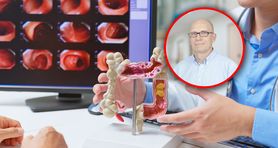 Skok "raka bogatych" o 80 proc. "Obserwujemy falę młodych pacjentów"
