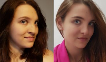 Magdalena Grochocka urodziła się z rozszczepem wargi i podniebienia. Jednym postem wywołała ważną dyskusję